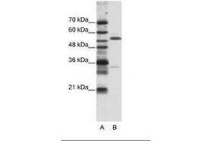 Image no. 1 for anti-Zinc Finger Protein 655 (ZNF655) (N-Term) antibody (ABIN203180) (ZNF655 抗体  (N-Term))