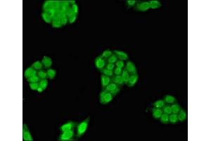 Immunofluorescent analysis of PC-3 cells using ABIN7159078 at dilution of 1:100 and Alexa Fluor 488-congugated AffiniPure Goat Anti-Rabbit IgG(H+L) (MXI1 抗体  (AA 75-173))