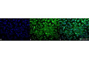 Immunocytochemistry/Immunofluorescence analysis using Rabbit Anti-p38 Polyclonal Antibody . (MAPK14 抗体  (Biotin))