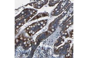 Immunohistochemical staining of human colon with WSCD2 polyclonal antibody  shows strong cytoplasmic positivity, with a granular pattern, in glandular cells. (WSCD2 抗体)