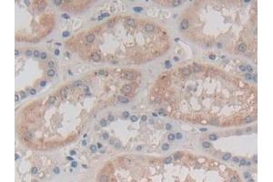 Detection of CAPN3 in Human Kidney Tissue using Polyclonal Antibody to Calpain 3 (CAPN3) (Calpain 3 抗体  (AA 602-821))