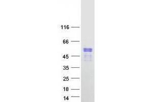 Western Blotting (WB) image for Pre-B-Cell Leukemia Homeobox Protein 2 (PBX2) protein (Myc-DYKDDDDK Tag) (ABIN2728339)