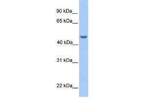 ASB6 antibody used at 1 ug/ml to detect target protein. (ASB6 抗体  (Middle Region))