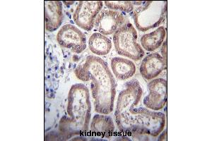 S Antibody (Center) (ABIN656799 and ABIN2846017) immunohistochemistry analysis in formalin fixed and paraffin embedded human kidney tissue followed by peroxidase conjugation of the secondary antibody and DAB staining. (SP140 抗体  (AA 272-301))
