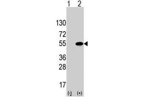 Western blot analysis of ATF4 (arrow) using rabbit ATF4 polyclonal antibody . (ATF4 抗体  (Ser245))