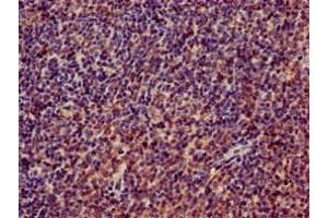 Immunohistochemistry of paraffin-embedded human lymph node tissue using ABIN7142825 at dilution of 1:100 (RPL4 抗体  (AA 12-91))