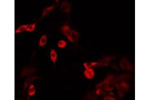 ABIN6275182 staining HT29 by IF/ICC. (GBP3 抗体  (C-Term))