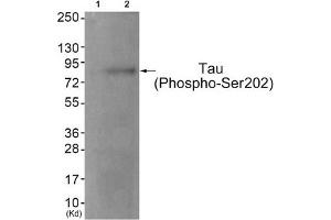 Western blot analysis of extracts from JK cells (Lane 2), using Tau (Phospho-Ser202) Antibody. (MAPT 抗体  (pSer202))