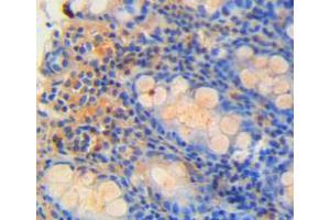 Used in DAB staining on fromalin fixed paraffin-embedded rectum tissue (REG4 抗体  (AA 45-151))