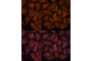 Immunofluorescence analysis of U-2 OS cells using NEXN antibody (ABIN6132932, ABIN6144546, ABIN6144547 and ABIN6217017) at dilution of 1:100. (NEXN 抗体  (AA 516-675))
