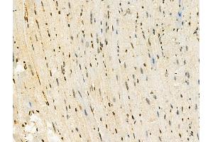 Phospho-MSH6 (Ser14) Antibody at 1/100 staining Mouse heart tissue by IHC-P. (MSH6 抗体  (pSer14))