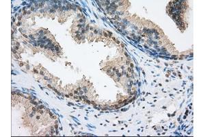 Immunohistochemical staining of paraffin-embedded pancreas tissue using anti-ERCC1 mouse monoclonal antibody. (ERCC1 抗体)