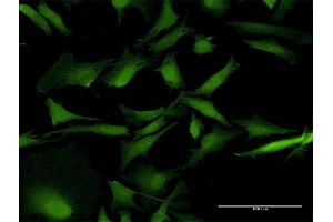 Immunofluorescence of purified MaxPab antibody to RAB31 on HeLa cell. (RAB31 抗体  (AA 1-195))