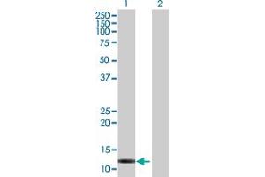 Western Blot analysis of FABP6 expression in transfected 293T cell line by FABP6 MaxPab polyclonal antibody. (FABP6 抗体  (AA 1-128))