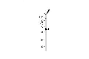Lane 1: Daudi Cell lysates, probed with USP22 (1154CT13. (USP22 抗体)