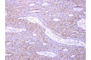 Immunohistochemistry (IHC) image for anti-Actin Related Protein 2/3 Complex, Subunit 1B, 41kDa (ARPC1B) (N-Term) antibody (ABIN2855927)