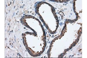 Immunohistochemical staining of paraffin-embedded Human liver tissue using anti-SNX9 mouse monoclonal antibody. (SNX9 抗体)
