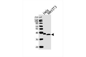 Lane 1: Hela Cell lysates, Lane 2: NIH/3T3 Cell lysates, probed with NFKBIA (1121CT8. (NFKBIA 抗体)