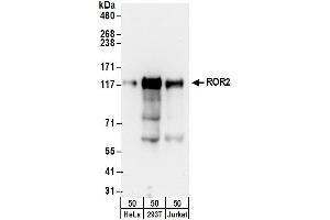 Western Blotting (WB) image for anti-Receptor Tyrosine Kinase-Like Orphan Receptor 2 (ROR2) (AA 893-943) antibody (ABIN7450672)