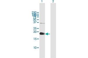 Western Blot analysis of ZCCHC13 expression in transfected 293T cell line by ZCCHC13 MaxPab polyclonal antibody. (ZCCHC13 抗体  (AA 1-166))