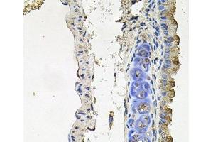 Immunohistochemistry of paraffin-embedded Mouse lung using NDUFA6 Polyclonal Antibody at dilution of 1:100 (40x lens). (NDUFA6 抗体)
