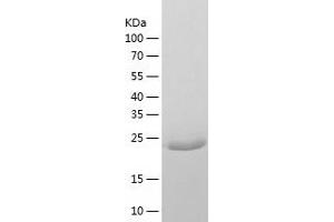 Western Blotting (WB) image for 3-Ketodihydrosphingosine Reductase (KDSR) (AA 26-270) protein (His tag) (ABIN7121613) (FVT1 Protein (AA 26-270) (His tag))