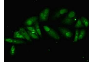 Immunofluorescent analysis of Hela cells using ABIN7155120 at dilution of 1:100 and Alexa Fluor 488-congugated AffiniPure Goat Anti-Rabbit IgG(H+L) (HNRNPL 抗体  (AA 89-335))