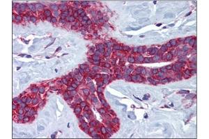 Human Breast: Formalin-Fixed, Paraffin-Embedded (FFPE) (Cathepsin L2 抗体  (Internal Region))