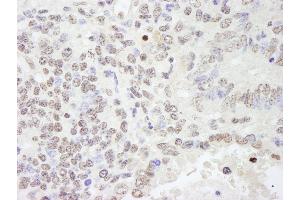 Immunohistochemistry (IHC) image for anti-RNA Binding Motif Protein 25 (RBM25) (AA 475-525) antibody (ABIN7448762)