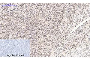 Immunohistochemical analysis of paraffin-embedded human uterus tissue.