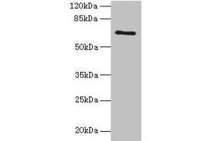 Western blot All lanes: HEATR9 antibody at 1. (C17orf66 抗体  (AA 1-219))