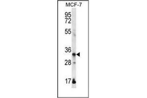 Western blot analysis of EVPLL Antibody (Center) in MCF-7 cell line lysates (35ug/lane). (Envoplakin-Like 抗体  (Middle Region))
