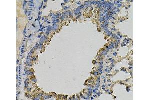 Immunohistochemistry of paraffin-embedded Mouse lung using PSAT1 Polyclonal Antibody at dilution of 1:100 (40x lens). (PSAT1 抗体)