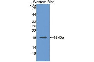 Western blot analysis of the recombinant protein. (MAN2B1 抗体  (AA 883-1011))