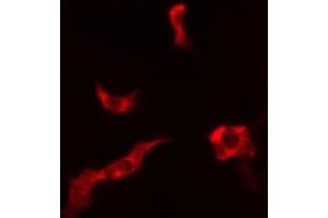 ABIN6266975 staining LOVO cells by IF/ICC.