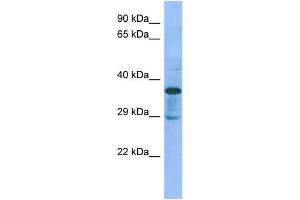 Host:  Rabbit  Target Name:  C1galt1c1  Sample Type:  Rat pancreas lysates  Antibody Dilution:  1. (C1GALT1C1 抗体  (N-Term))