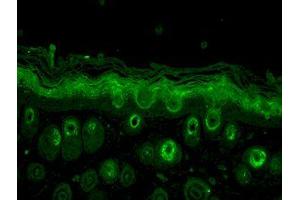 Immunohistochemistry analysis using Rabbit Anti-Rab5 Polyclonal Antibody . (RAB5 抗体  (HRP))