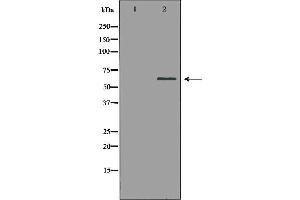 Western blot analysis of extracts of mouse kidney, using PAK1 antibody. (PAK1 抗体  (N-Term))