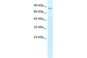 Western Blotting (WB) image for anti-Activating Transcription Factor 6 beta (ATF6B) antibody (ABIN2460387) (ATF6B 抗体)