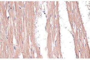 Immunohistochemistry of paraffin-embedded Rat heart using COL11A1 Polyclonal Antibody at dilution of 1:100 (40x lens). (COL11A1 抗体)