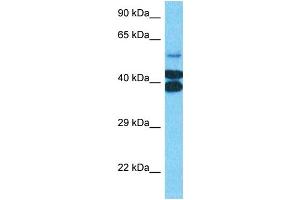 Host:  Rabbit  Target Name:  PTOV1  Sample Type:  Jurkat Whole Cell lysates  Antibody Dilution:  0. (PTOV1 抗体  (N-Term))