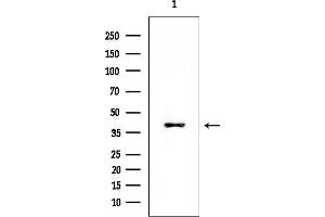 Western blot analysis of lysates from Mouse liver, using CACNG8 Mouse Monoclonal Antibody at 1/1000 dilution.