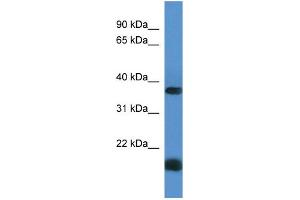Western Blotting (WB) image for anti-Rhomboid Domain Containing 1 (RHBDD1) (C-Term) antibody (ABIN2788470) (RHBDD1 抗体  (C-Term))