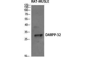 Western Blot (WB) analysis of specific cells using DARPP-32 Polyclonal Antibody. (DARPP32 抗体  (Tyr785))