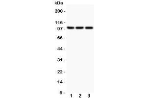 Western blot testing of NFKB2 antibody and Lane 1:  Jurkat;  2: A549;  3: MCF-7;  Expected size: 52 and 100KD, depending on sample tested (NFKB2 抗体  (AA 1-340))