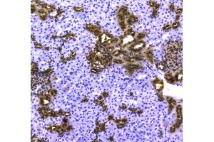 IHC analysis of 14-3-3 zeta/delta using anti-14-3-3 zeta/delta antibody . (14-3-3 zeta 抗体)