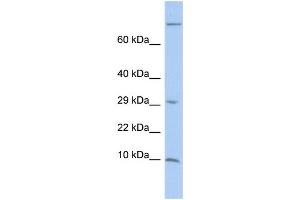 WB Suggested Anti-MGP Antibody Titration:  0. (MGP 抗体  (Middle Region))
