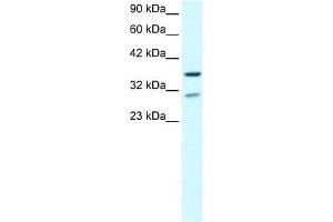 Human brain; WB Suggested Anti-ZNF385 Antibody Titration: 0. (ZNF385A 抗体  (N-Term))