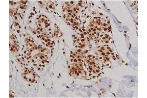ABIN6267607 at 1/200 staining Human heart tissue sections by IHC-P.