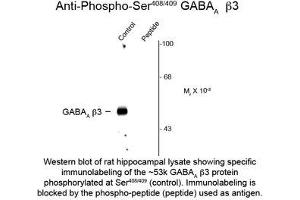 Image no. 1 for anti-gamma-aminobutyric Acid (GABA) A Receptor, beta 2 (GABRB2) (pSer408), (Ser409) antibody (ABIN956760) (GABRB2 抗体  (pSer408, Ser409))